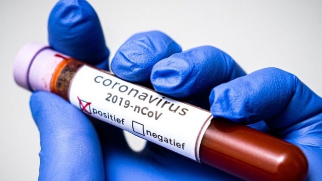 Health Workers Test Positive For Coronavirus In Plateau