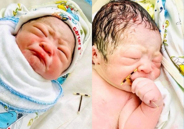 Baby Makes Entrance Into This World, Holding Firmly His Mum's Contraceptive Coil