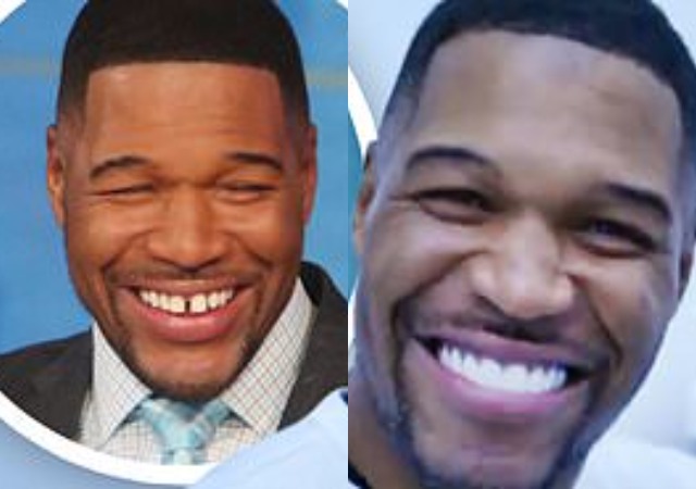 Ex - NFL Player Closes His Signature Gap Tooth