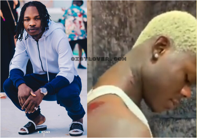 How Mohbad went on a biting spree after he got ‘high’ – Naira Marley speaks shares proof [Video]