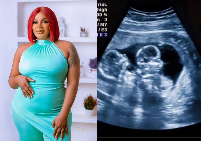 “Mama Ejima”- Reactions as Uche Ogbodo as she shares her ultrasound result