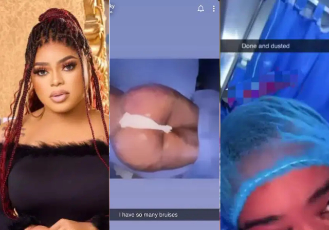 “I pray all my bruises clear” – Bobrisky shows of his newly acquired body following successful BBL surgery