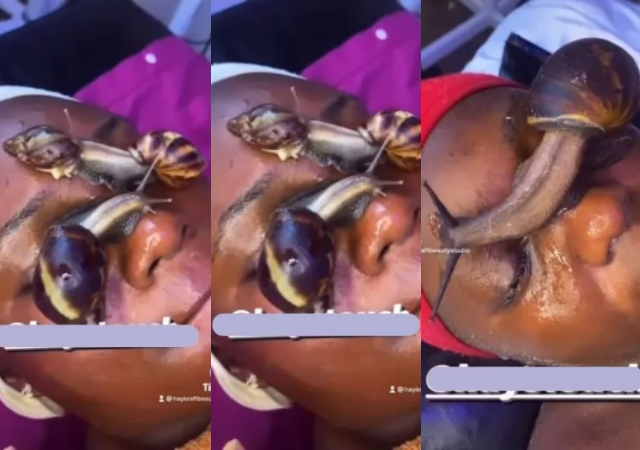 “Make Aproko doctor catch you first” – Video of live snails crawling on lady’s face stirs reactions