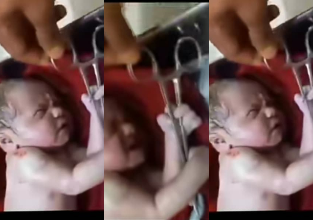 "I'm seeing a future tailor" -Reactions as newborn baby tightly holds forceps during umbilical cord cutting