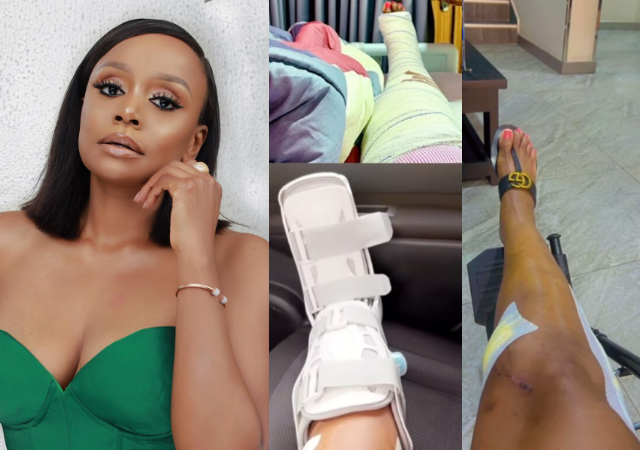 Actress Michelle Dede shares near-leg amputation following accident