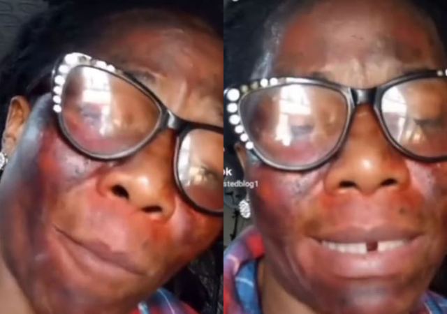 My husband’s side chic gave me acid as organic product for face – Woman claims