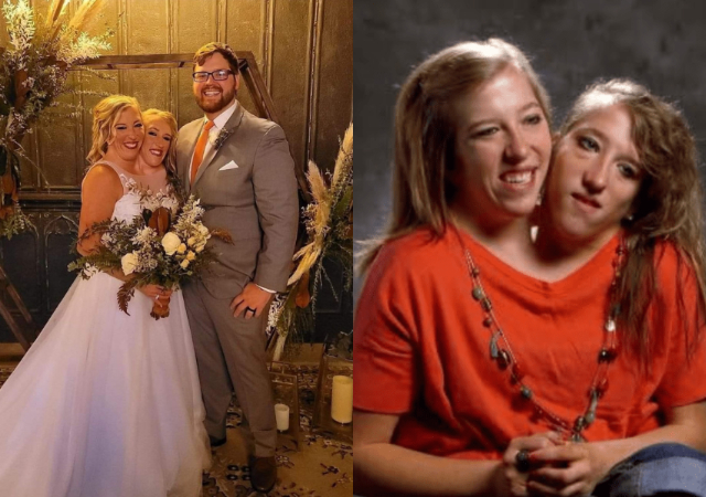 Conjoined twins, Abby Hensel gets married to her fiancée, Josh Bowling in a private ceremony