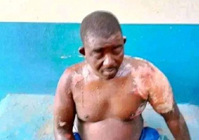 Newly Wedded Wife Bathed Her Husband With Hot Water For Stopping Her From Calling Other Men