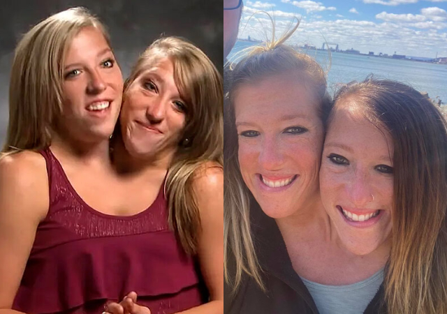 “Yes my husband and I get intimate” – Abby Hensel, Conjoined twins responds to queries of netizens