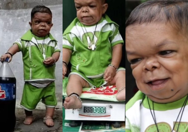 Pictures of 25-year-old man who stopped growing in height at age 5 surfaces online