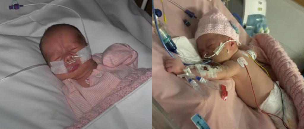 Newborn Baby Hospitalized After Receiving a Kiss

