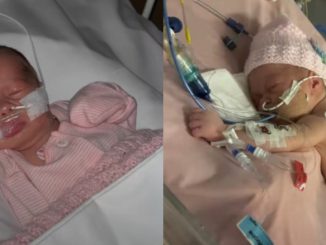 Newborn Baby Hospitalized After Receiving a Kiss