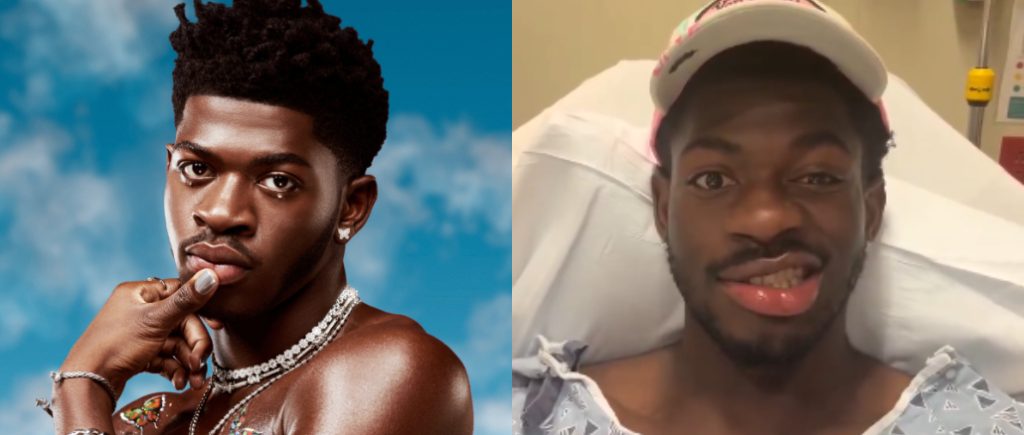 Lil Nas X opens up about battle with facial paralysis