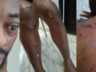 Photos surface as the NANS president alleges assault by Seyi Tinubu's thugs