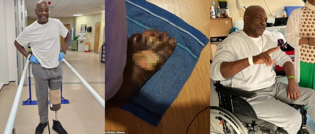 London-Based Nigerian Man Loses Leg After Pedicure Mishap

