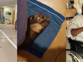 London-Based Nigerian Man Loses Leg After Pedicure Mishap