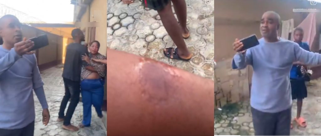 Drama as Nigerian Landlady Bites Tenant During Heated Dispute