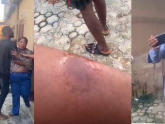 Drama as Nigerian Landlady Bites Tenant During Heated Dispute