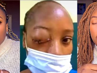 Woman Shares How She Went Blind During Pregnancy, Lost Baby